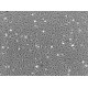 Human Dermal Microvascular Endothelial Cells (HDMVEC)